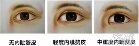 https://img.miyanlife.com/mnt/timg/180314/1443102Q7-5.jpg
