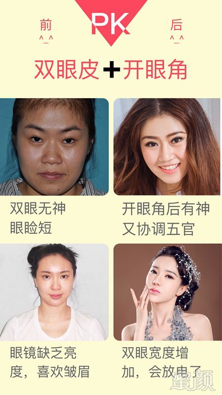 https://img.miyanlife.com/mnt/timg/180314/1443114542-9.jpg