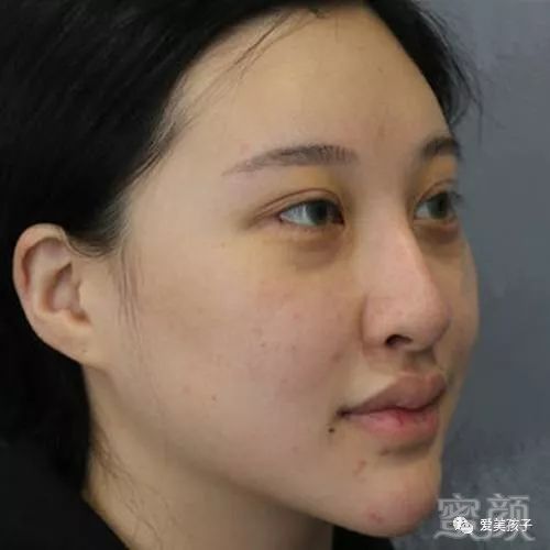 https://img.miyanlife.com/mnt/timg/180315/10463CJ2-0.jpg