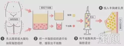 案例图片