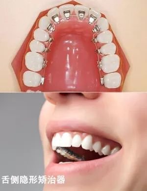 https://img.miyanlife.com/mnt/timg/180315/1145323204-6.jpg