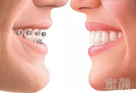 https://img.miyanlife.com/mnt/timg/180315/1145326044-4.jpg