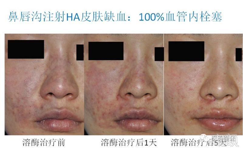 https://img.miyanlife.com/mnt/timg/180315/11500532L-2.jpg