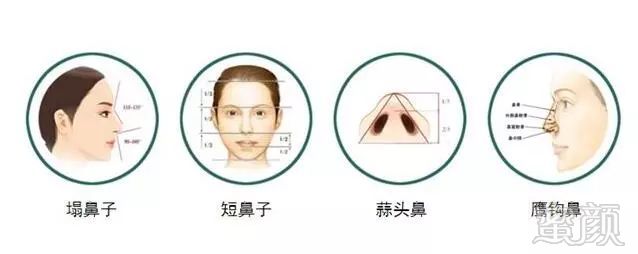 https://img.miyanlife.com/mnt/timg/180315/1201503355-8.jpg