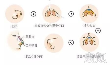 https://img.miyanlife.com/mnt/timg/180315/1201503E8-10.jpg