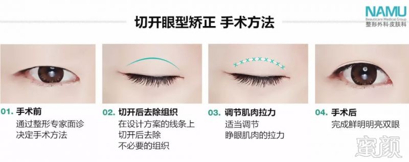 https://img.miyanlife.com/mnt/timg/180315/12092H228-8.jpg