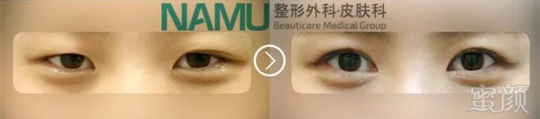 https://img.miyanlife.com/mnt/timg/180315/12092I209-11.jpg