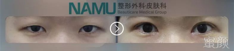 https://img.miyanlife.com/mnt/timg/180315/12092J5X-10.jpg