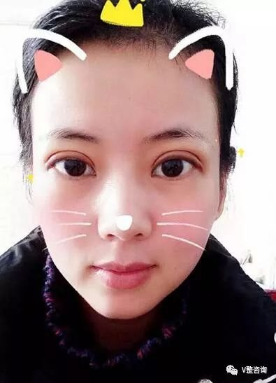https://img.miyanlife.com/mnt/timg/180315/120KH295-4.jpg