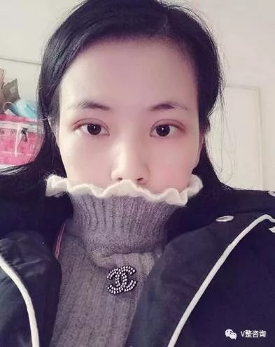https://img.miyanlife.com/mnt/timg/180315/120KM1T-5.jpg