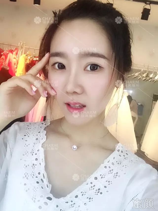 https://img.miyanlife.com/mnt/timg/180315/120Z93D7-7.jpg