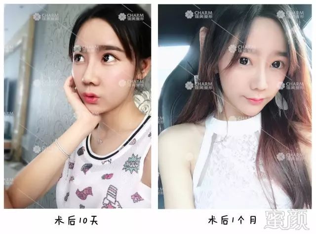 https://img.miyanlife.com/mnt/timg/180315/120Z94B4-8.jpg