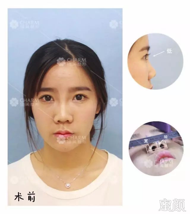https://img.miyanlife.com/mnt/timg/180315/120ZQ622-6.jpg