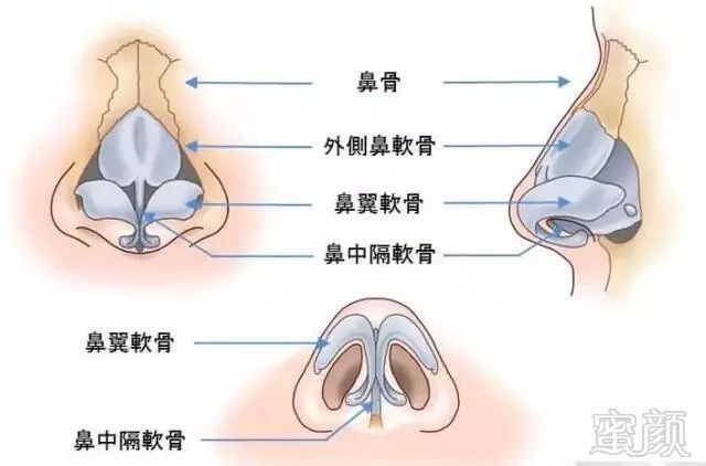 https://img.miyanlife.com/mnt/timg/180315/120ZUZ0-5.jpg