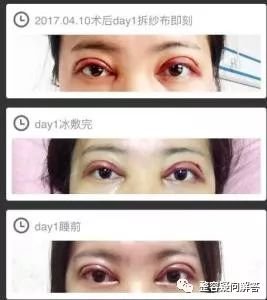 https://img.miyanlife.com/mnt/timg/180316/110I32E6-0.jpg