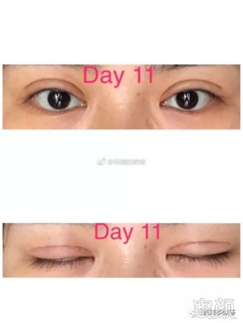 https://img.miyanlife.com/mnt/timg/180316/110I35223-1.jpg