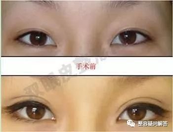 https://img.miyanlife.com/mnt/timg/180316/110I44927-5.jpg
