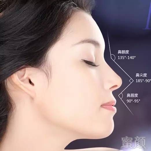 https://img.miyanlife.com/mnt/timg/180316/110UB037-4.jpg