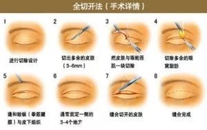 https://img.miyanlife.com/mnt/timg/180316/1119143117-1.jpg