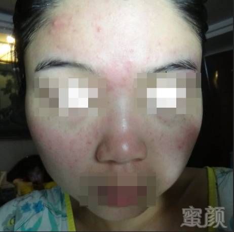 https://img.miyanlife.com/mnt/timg/180316/1131262L3-0.jpg