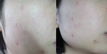 https://img.miyanlife.com/mnt/timg/180316/11312B928-4.jpg