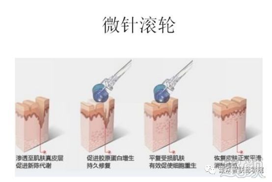 https://img.miyanlife.com/mnt/timg/180316/11321223L-1.jpg