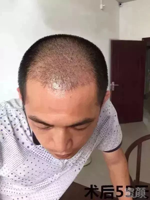 https://img.miyanlife.com/mnt/timg/180316/11333L0I-9.jpg