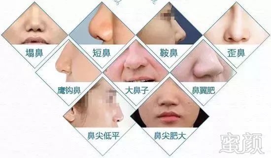 https://img.miyanlife.com/mnt/timg/180316/115T15944-1.jpg