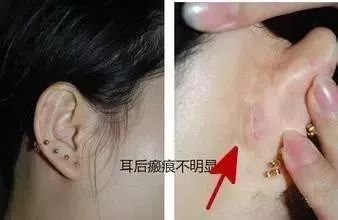 https://img.miyanlife.com/mnt/timg/180316/115T21549-5.jpg