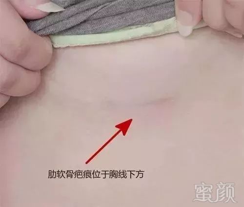 https://img.miyanlife.com/mnt/timg/180316/115T24930-7.jpg