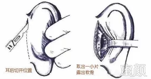 https://img.miyanlife.com/mnt/timg/180316/115T2CH-4.jpg