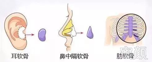 https://img.miyanlife.com/mnt/timg/180316/115T2GV-3.jpg
