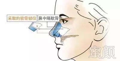 https://img.miyanlife.com/mnt/timg/180316/115T34619-8.jpg