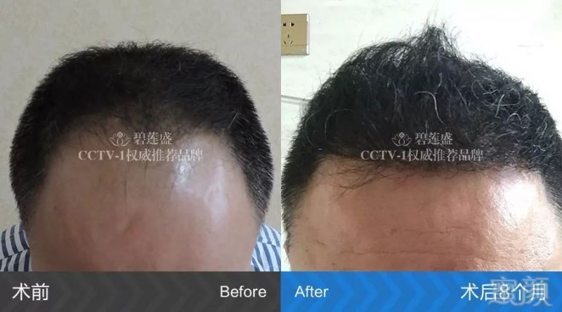 https://img.miyanlife.com/mnt/timg/180316/1212391317-3.jpg