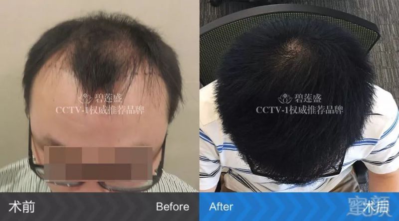 https://img.miyanlife.com/mnt/timg/180316/12123961T-4.jpg