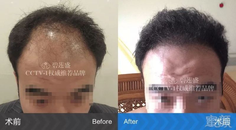 https://img.miyanlife.com/mnt/timg/180316/12123U035-1.jpg