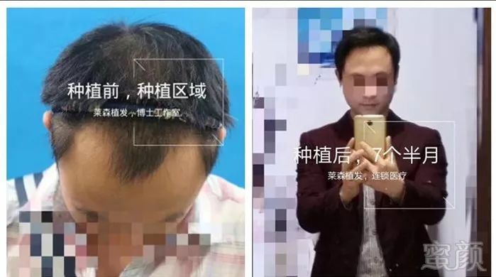 https://img.miyanlife.com/mnt/timg/180316/1214304023-5.jpg