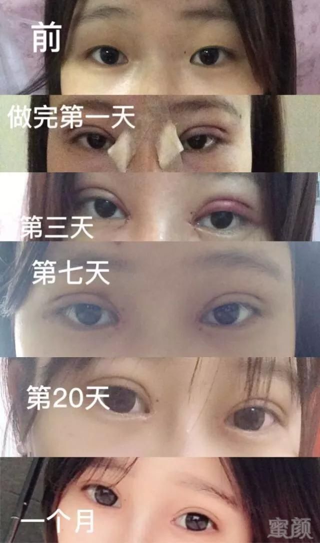 https://img.miyanlife.com/mnt/timg/180316/13032633I-2.jpg