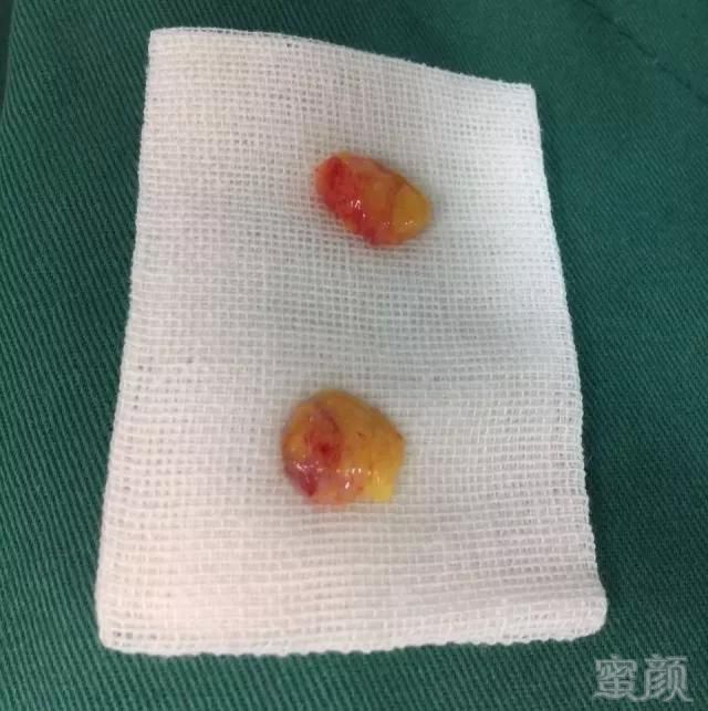 https://img.miyanlife.com/mnt/timg/180316/13032B4M-1.jpg
