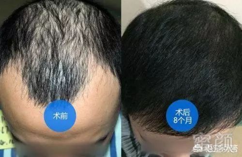 https://img.miyanlife.com/mnt/timg/180317/12310A4K-1.jpg