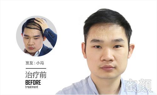 https://img.miyanlife.com/mnt/timg/180317/124103D40-1.jpg