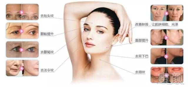 https://img.miyanlife.com/mnt/timg/180317/1251413331-3.jpg