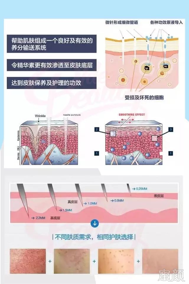 https://img.miyanlife.com/mnt/timg/180318/1340003303-1.jpg