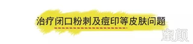 https://img.miyanlife.com/mnt/timg/180318/1340005151-2.jpg