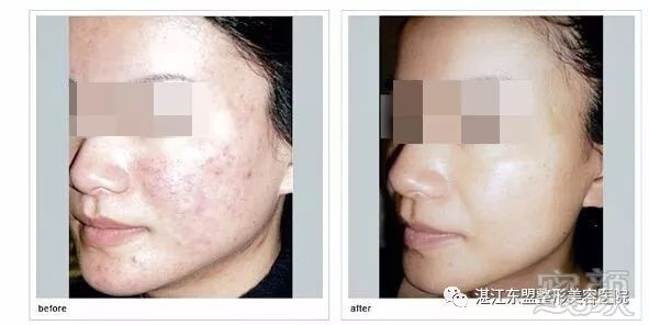https://img.miyanlife.com/mnt/timg/180319/1101555K9-5.jpg