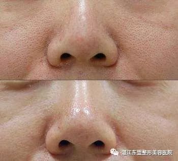 https://img.miyanlife.com/mnt/timg/180319/1101563I3-7.jpg