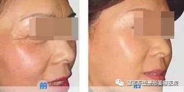 https://img.miyanlife.com/mnt/timg/180319/11015A250-6.jpg