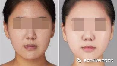 https://img.miyanlife.com/mnt/timg/180319/11015B913-8.jpg