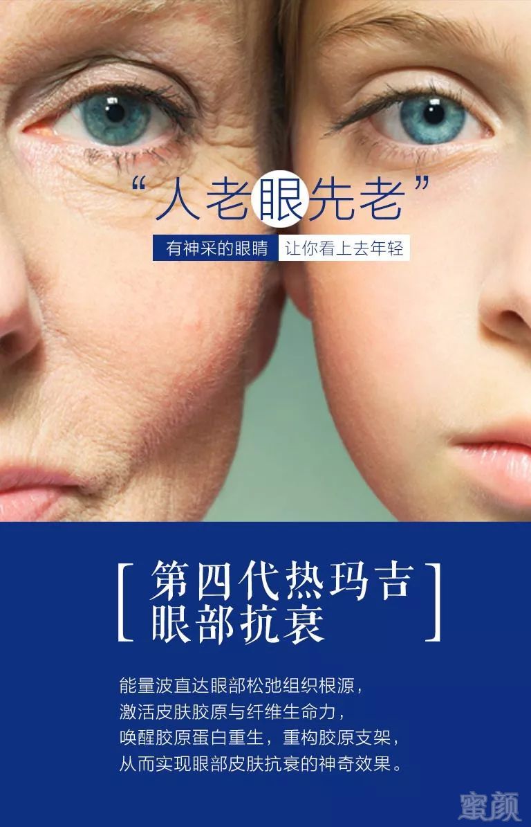 https://img.miyanlife.com/mnt/timg/180319/11160a2V-3.jpg