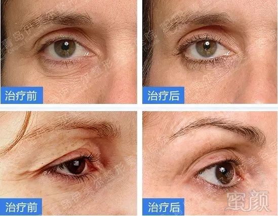 https://img.miyanlife.com/mnt/timg/180319/111610E30-6.jpg